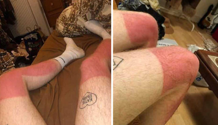 Never Forget Sunscreen!