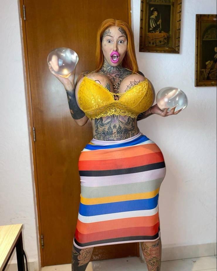 Plastic Surgery Fanatic Revealed Her Pre-Surgery Photos