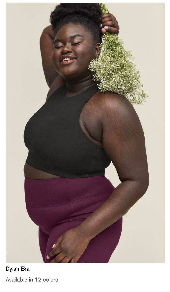 People Showing Their Real, Unedited Beauty