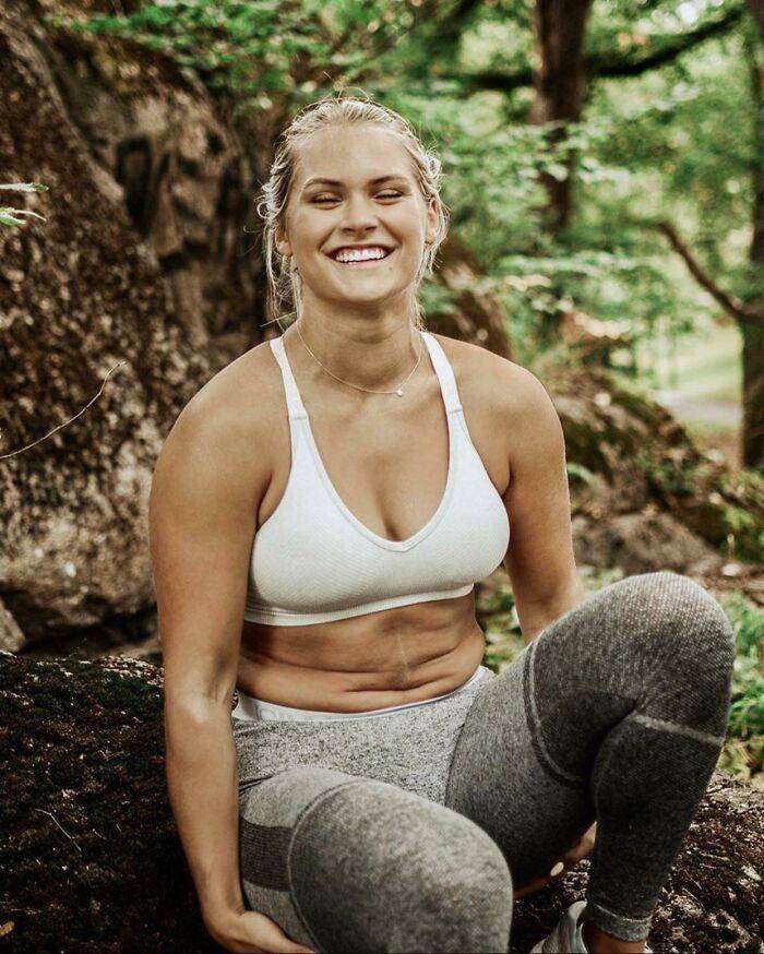 People Showing Their Real, Unedited Beauty