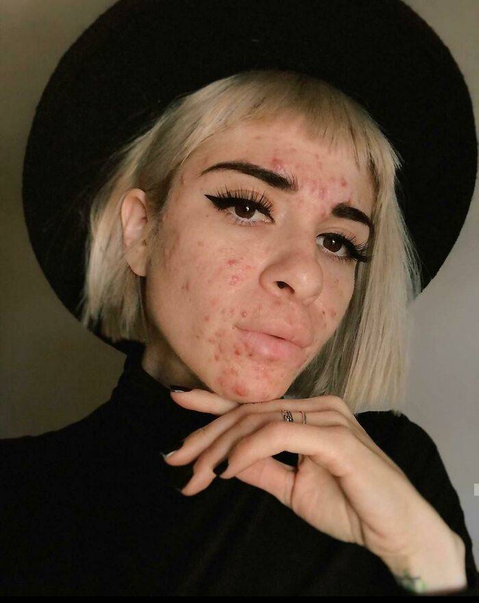 People Showing Their Real, Unedited Beauty