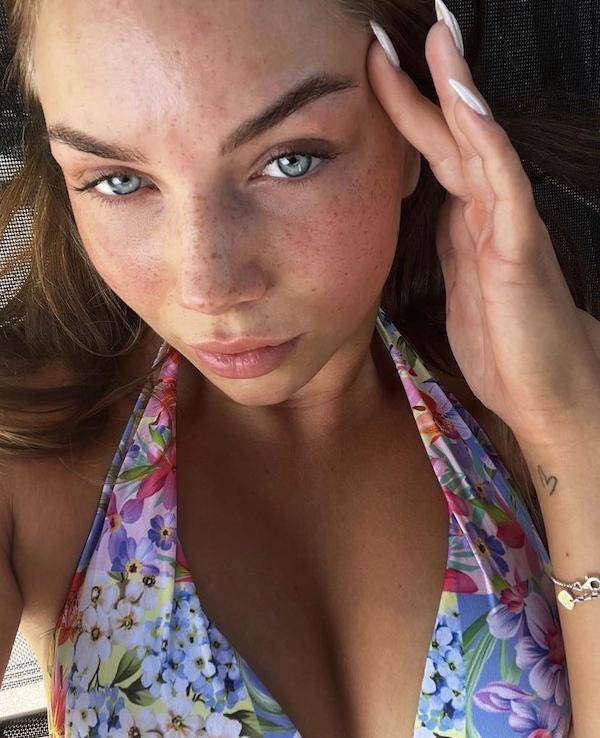 the charm of freckled faces 53 pics 14.html - 53 HD Photos | Premium Gallery 2023