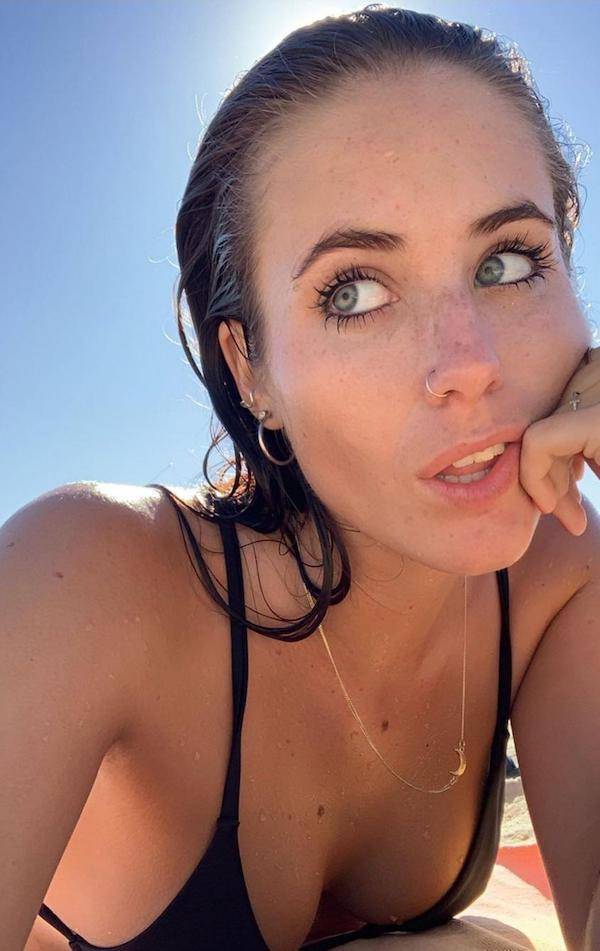 the charm of freckled faces 33 pics 15.html - 33 HD Photos | Premium Gallery 2023