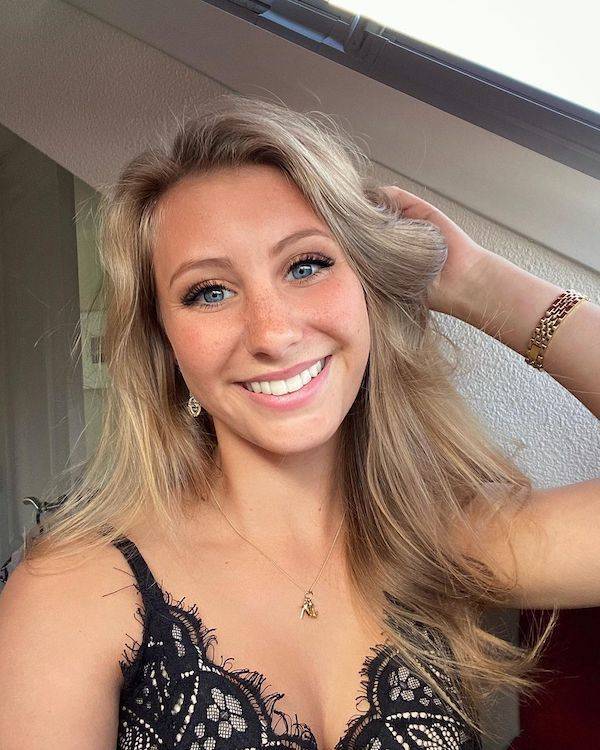 the charm of freckled faces 33 pics 15.html - 33 HD Photos | Premium Gallery 2023