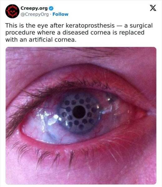 Disturbing 