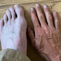 homemade wound makeup 8 pics.html - 8 HD Photos | Premium Gallery 2012