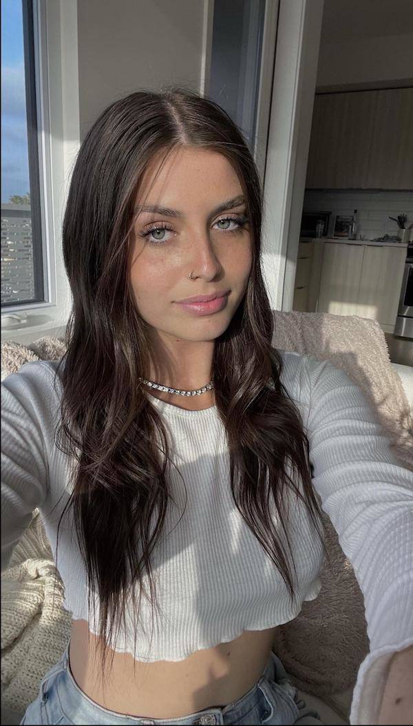 the charm of freckled faces 51 pics 14.html - 51 HD Photos | Premium Gallery 2024