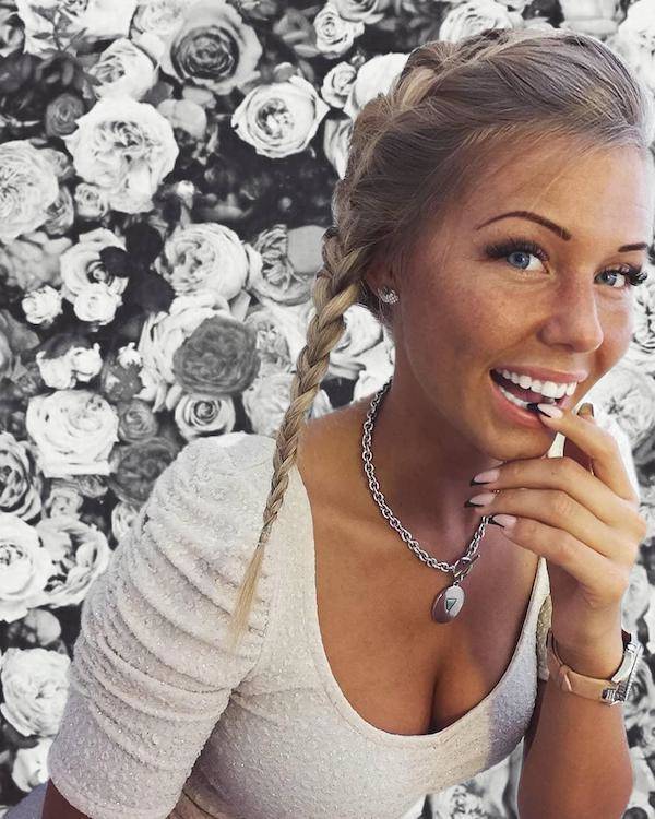 the charm of freckled faces 51 pics 14.html - 51 HD Photos | Premium Gallery 2024