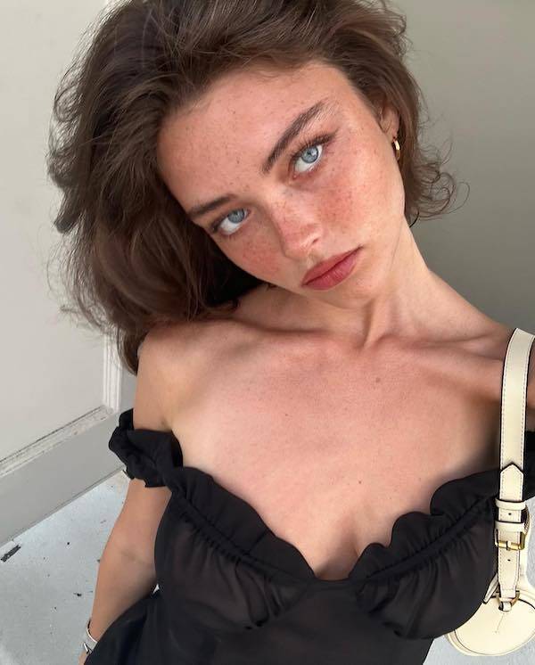 the charm of freckled faces 51 pics 14.html - 51 HD Photos | Premium Gallery 2024