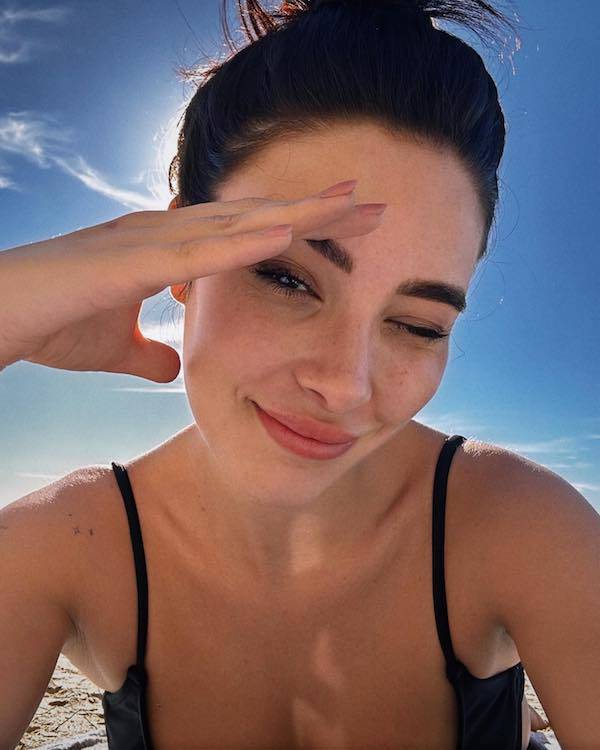 the charm of freckled faces 51 pics 14.html - 51 HD Photos | Premium Gallery 2024