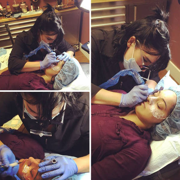 Some Try To Remove Their Natural Freckles – Others Tattoo Artificial Ones