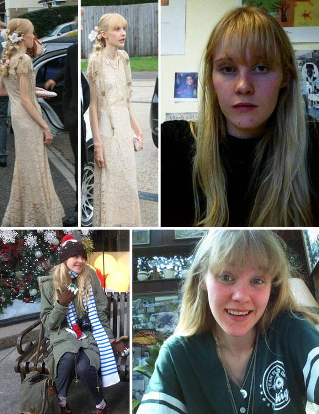 Anorexia Is Not The Final Verdict!