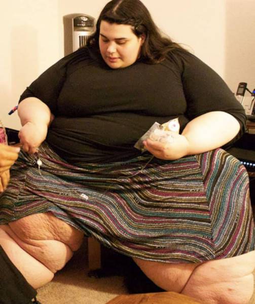 When Dedication Triumphs Over The Obesity