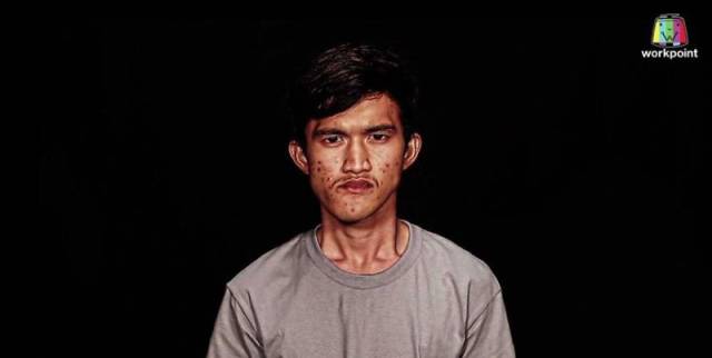 When Even Your Own Mother Can’t Recognize You After Plastic Surgery