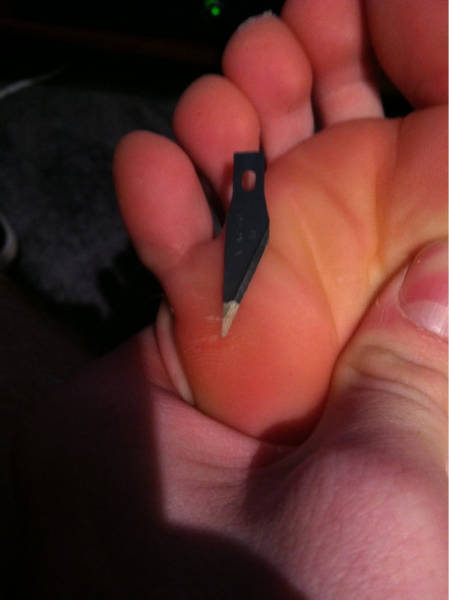 When Sh#t Is Literally Everywhere