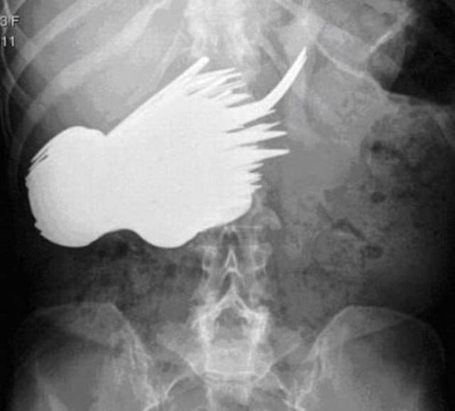 X-Rays That Will Make You Very Uncomfortable