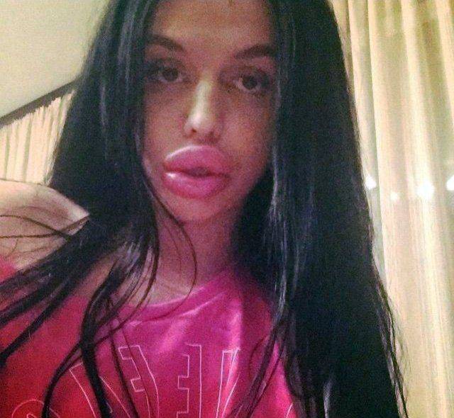 What Have They Done With Their Lips?!