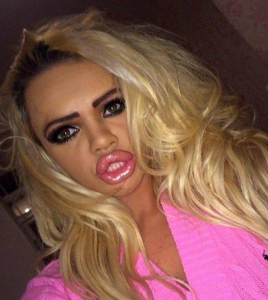 What Have They Done With Their Lips?!