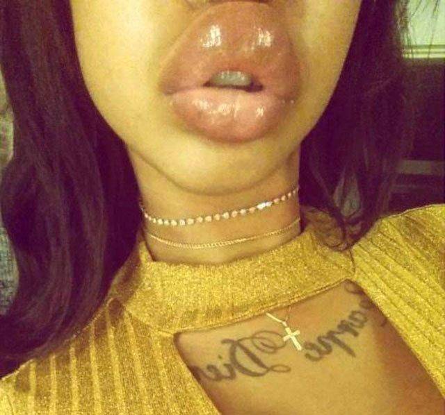 What Have They Done With Their Lips?!