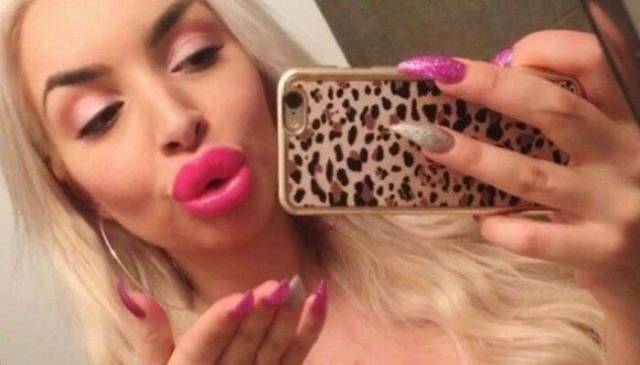 What Have They Done With Their Lips?!