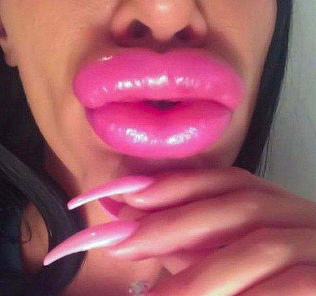 What Have They Done With Their Lips?!