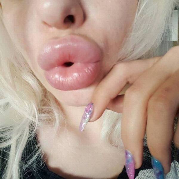 What Have They Done With Their Lips?!