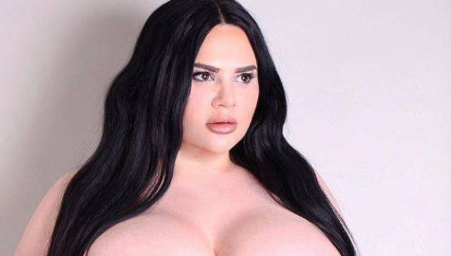 School Bullies Didn’t Stop Her From Becoming A Model