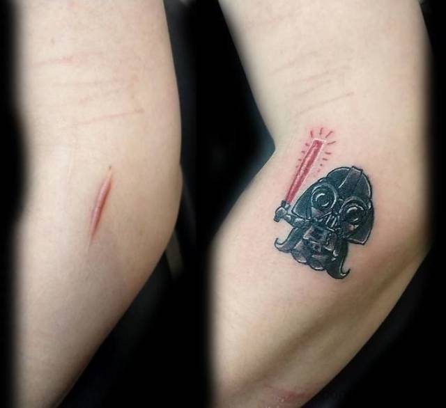 There Is No Scar That A Tattoo Artist Can’t Cover Up