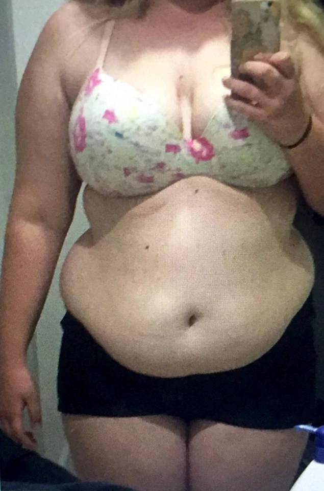 Girl Transforms Herself Completely By Losing 64 Kilos
