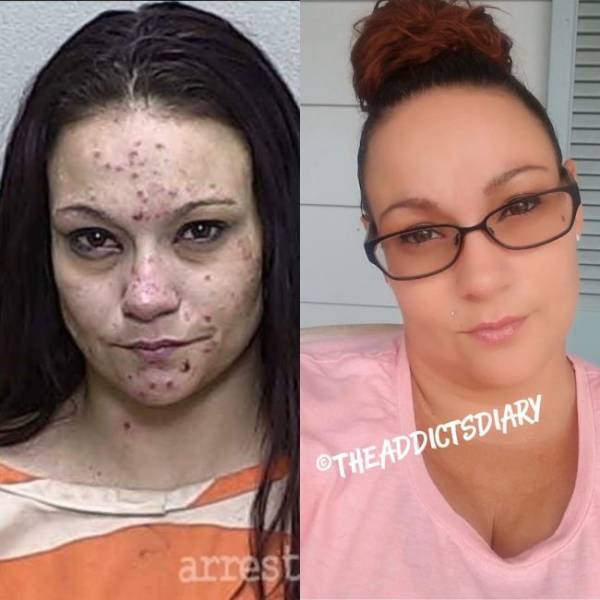 How Drug Addicts Transform After Getting Clean