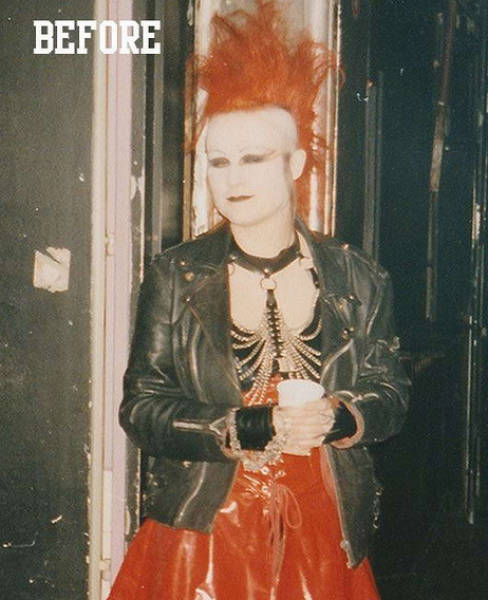 Plastic Surgeries Never Stopped…