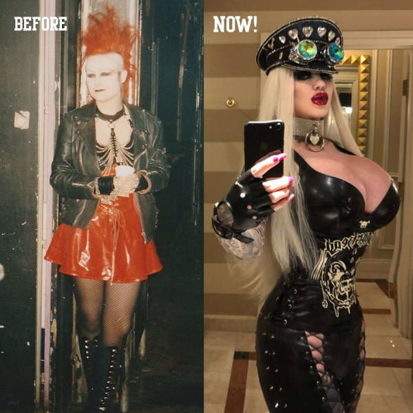 Plastic Surgeries Never Stopped…