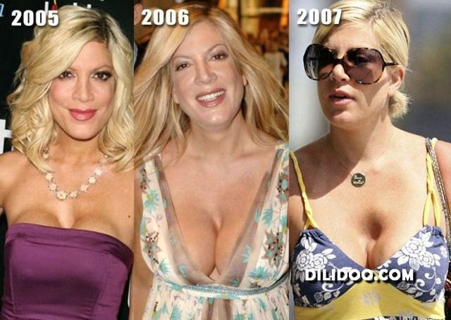 When plastic surgery fails (38 pics)