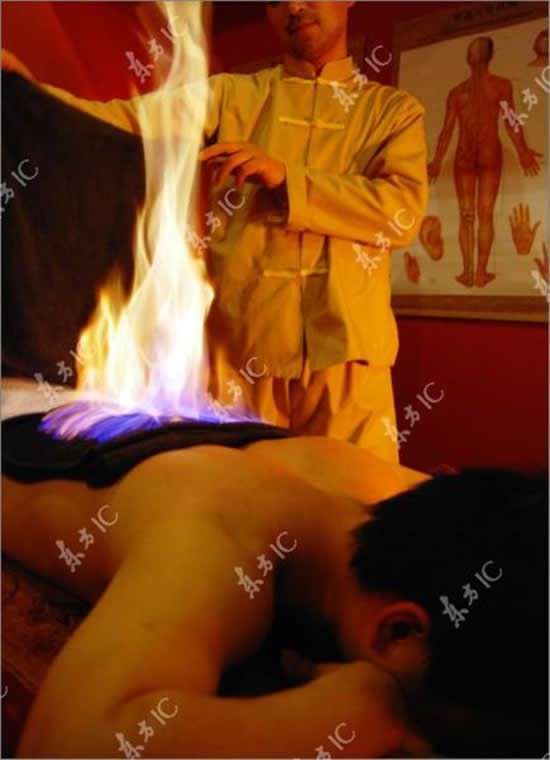Relax With Fire (8 pics)