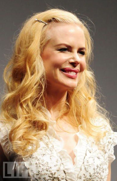 Celebrity Plastic Surgery Before & After