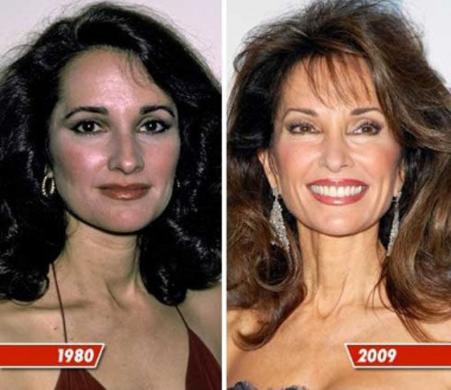 Celebrity Plastic Surgery Before & After