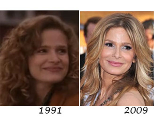 Celebrity Plastic Surgery Before & After