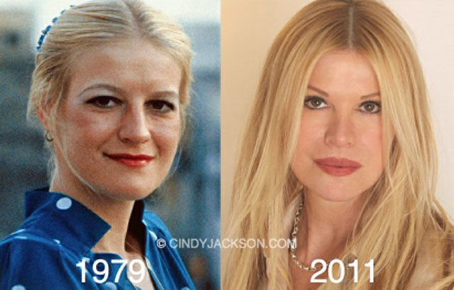 Celebrity Plastic Surgery Before & After