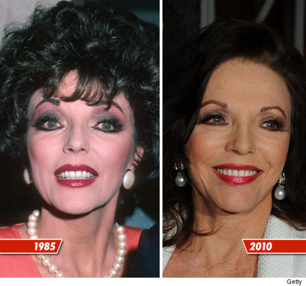 Celebrity Plastic Surgery Before & After