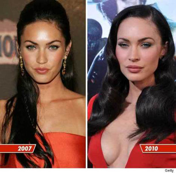 Celebrity Plastic Surgery Before & After
