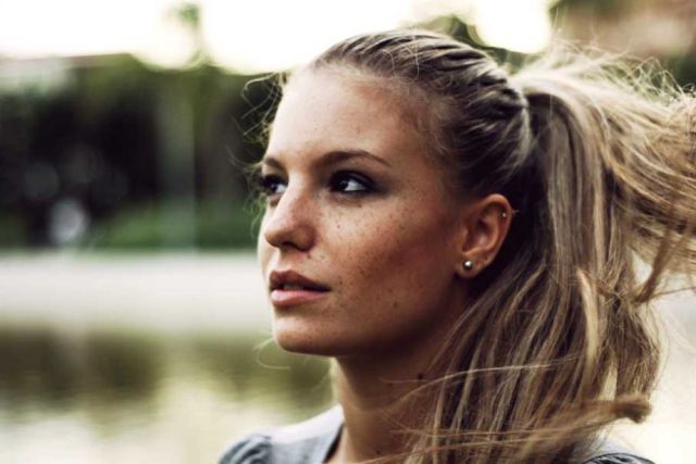 Freckles to the Front Please