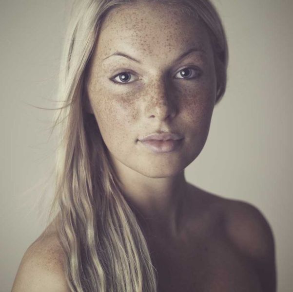 Freckles to the Front Please