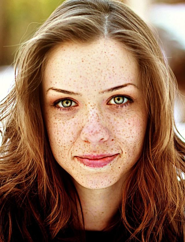 Freckles to the Front Please