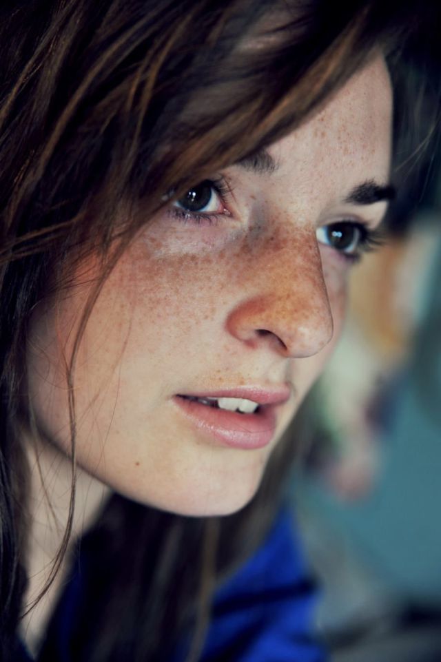 Freckles to the Front Please