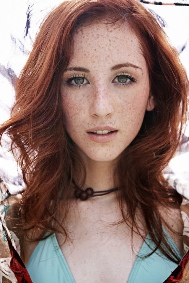 Freckles to the Front Please