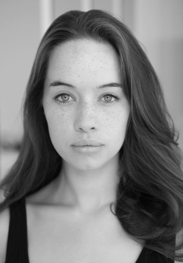 Freckles to the Front Please