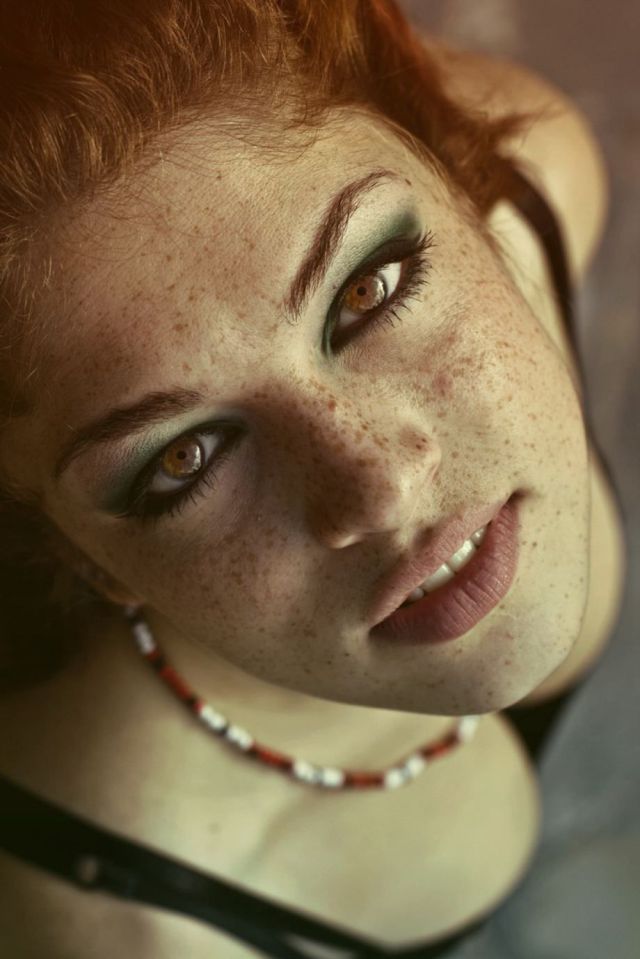 Freckles to the Front Please