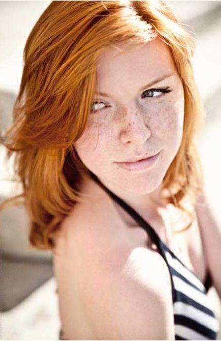 Freckles to the Front Please
