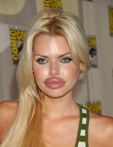 Ladies With Silicone Overdose