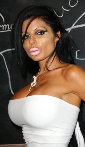 Ladies With Silicone Overdose